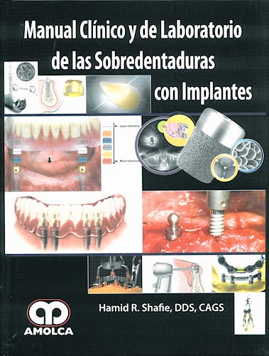 Portada del libro 9789588473161 Manual Clínico y de Laboratorio de las Sobredentaduras con Implantes