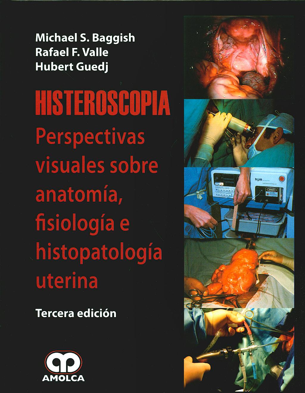 Portada del libro 9789588473208 Histeroscopia. Perspectivas Visuales de la Anatomía, Fisiología e Histopatología Uterina