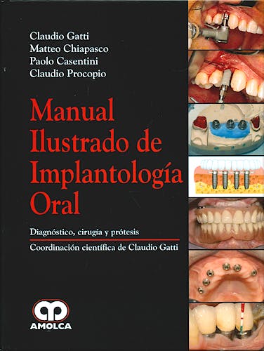 Portada del libro 9789588473260 Manual Ilustrado de Implantología Oral. Diagnóstico, Cirugía y Prótesis
