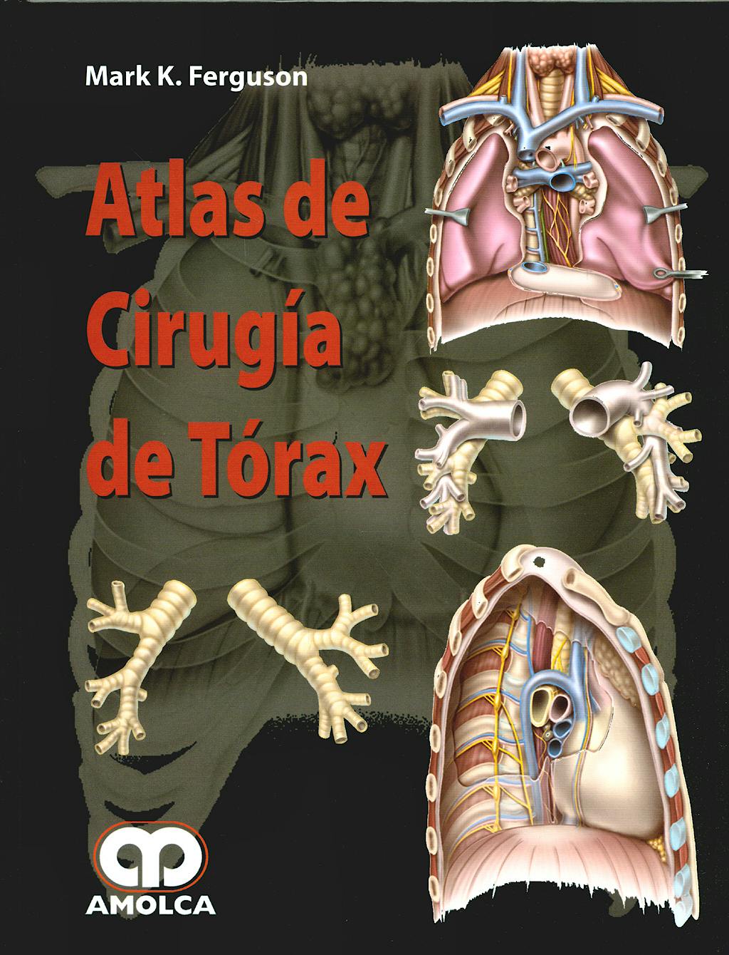 Portada del libro 9789588473277 Atlas de Cirugía de Tórax