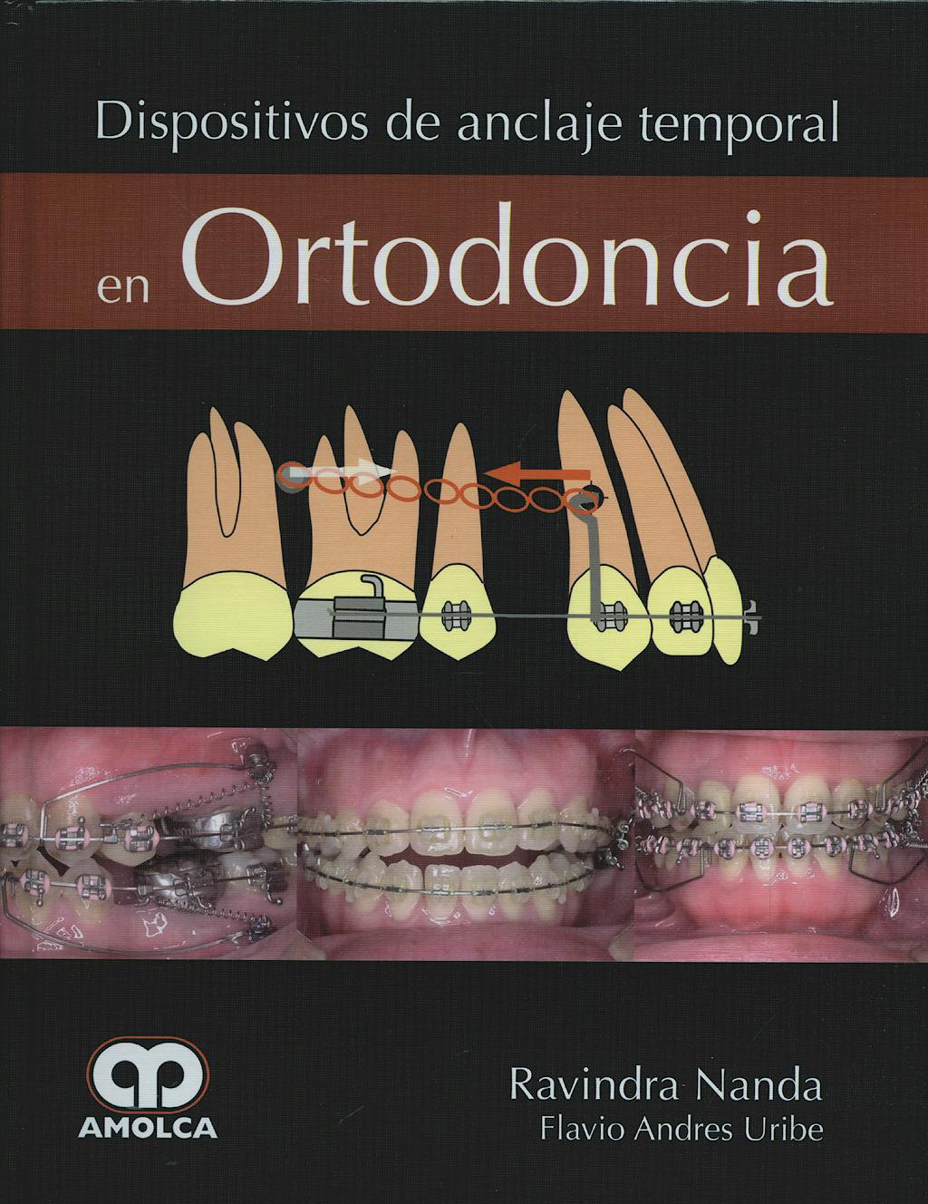 Portada del libro 9789588473451 Dispositivos de Anclaje Temporal en Ortodoncia