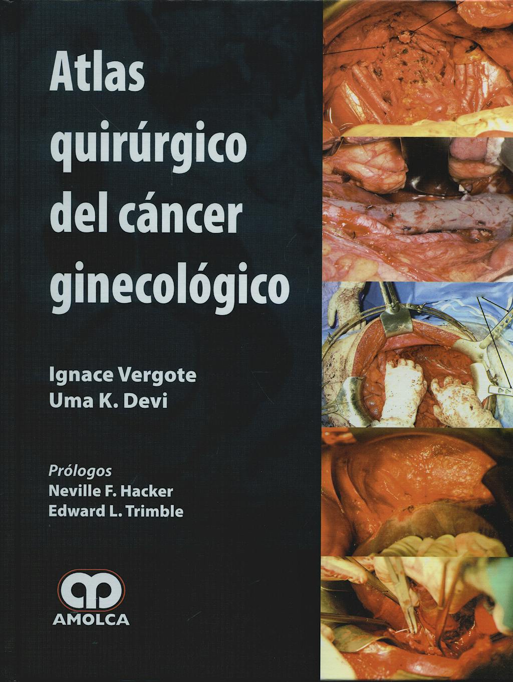 Portada del libro 9789588473512 Atlas Quirurgico del Cancer Ginecologico