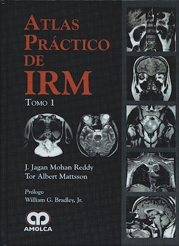 Portada del libro 9789588473529 Atlas Práctico de IRM, 2 Vols.