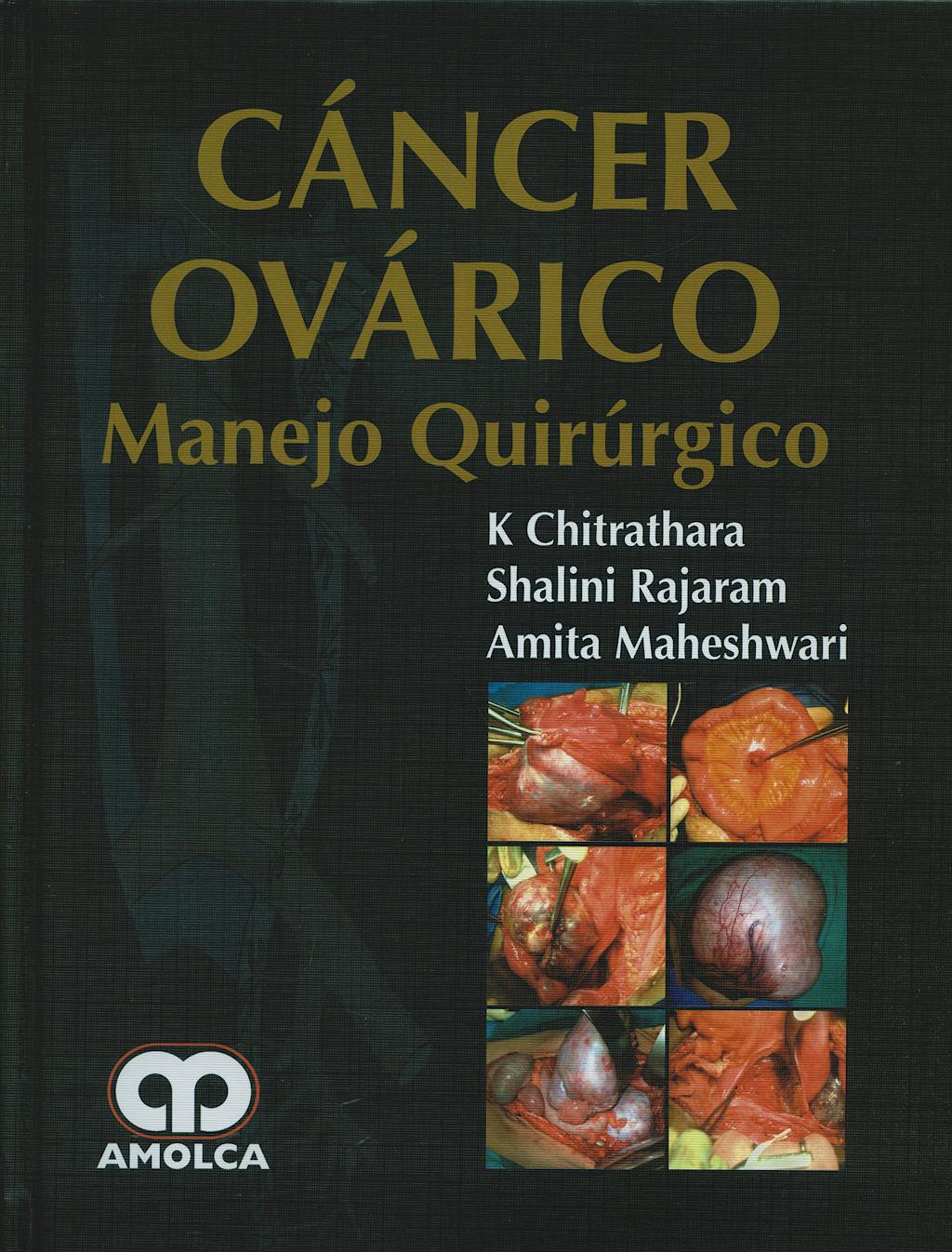Portada del libro 9789588473796 Cáncer Ovárico. Manejo Quirúrgico