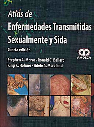 Portada del libro 9789588760001 Atlas de Enfermedades Transmitidas Sexualmente y Sida