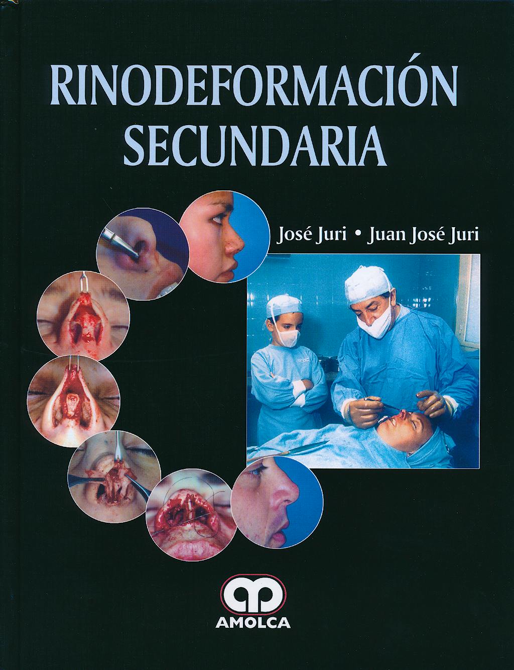 Portada del libro 9789588760117 Rinodeformación Secundaria