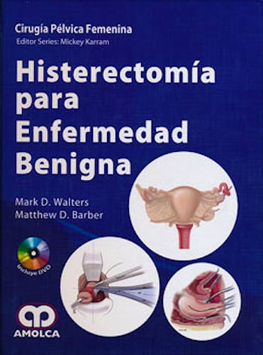Portada del libro 9789588760155 Histerectomía para Enfermedad Benigna (Cirugía Pélvica Femenina)
