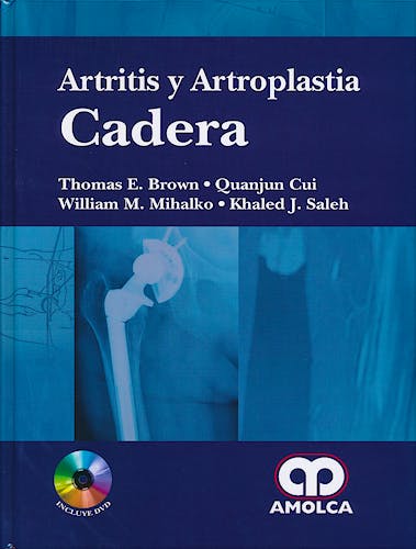 Portada del libro 9789588760193 Artritis y Artroplastia: Cadera