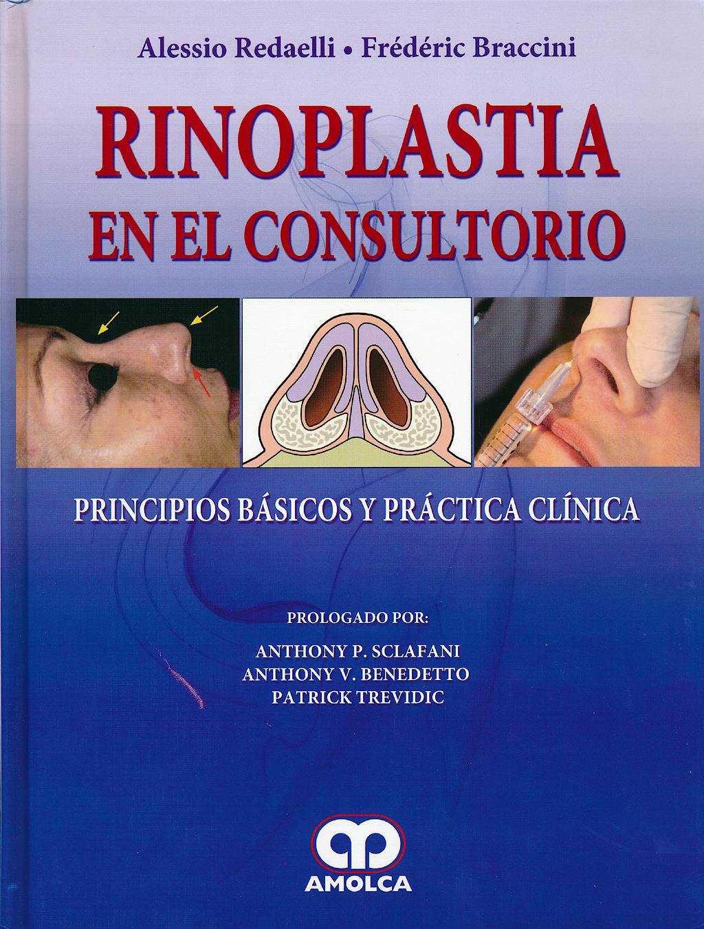 Portada del libro 9789588760223 Rinoplastia en el Consultorio. Principios Básicos y Práctica Clínica