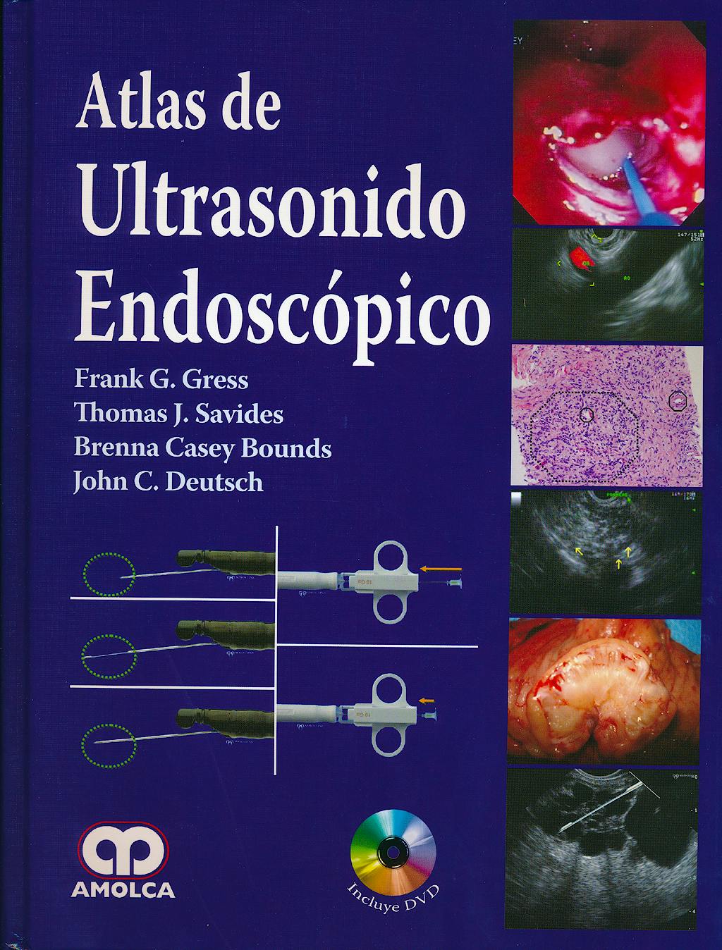 Portada del libro 9789588760315 Atlas de Ultrasonido Endoscópico