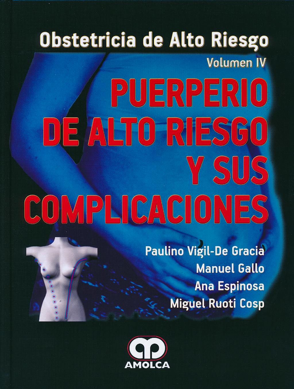 Portada del libro 9789588760322 Puerperio de Alto Riesgo y sus Complicaciones (Obstetricia de Alto Riesgo, Vol. IV)