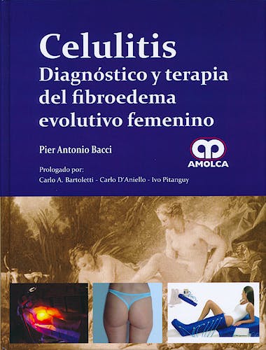 Portada del libro 9789588760391 Celulitis. Diagnóstico y Terapia del Fibroedema Evolutivo Femenino