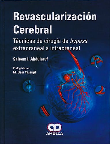 Portada del libro 9789588760414 Revascularización Cerebral. Técnicas de Cirugía de Bypass Extracraneal a Intracraneal
