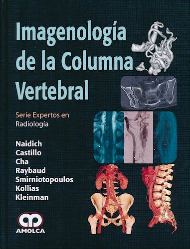 Portada del libro 9789588760438 Imagenología de la Columna Vertebral