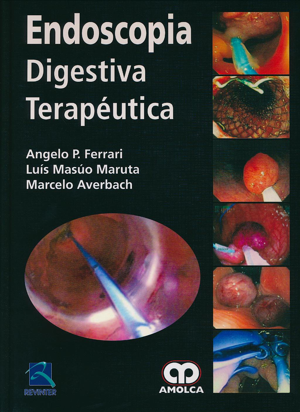 Portada del libro 9789588760445 Endoscopia Digestiva Terapéutica
