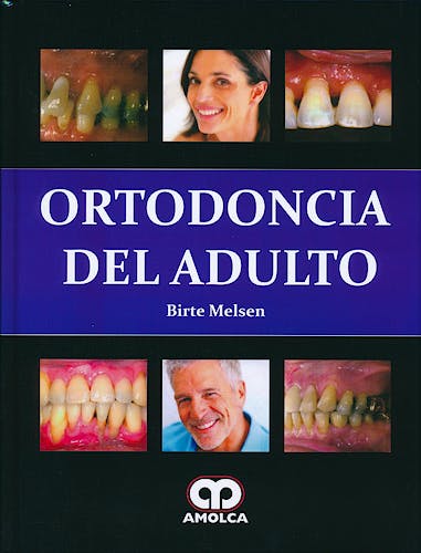 Portada del libro 9789588760490 Ortodoncia del Adulto
