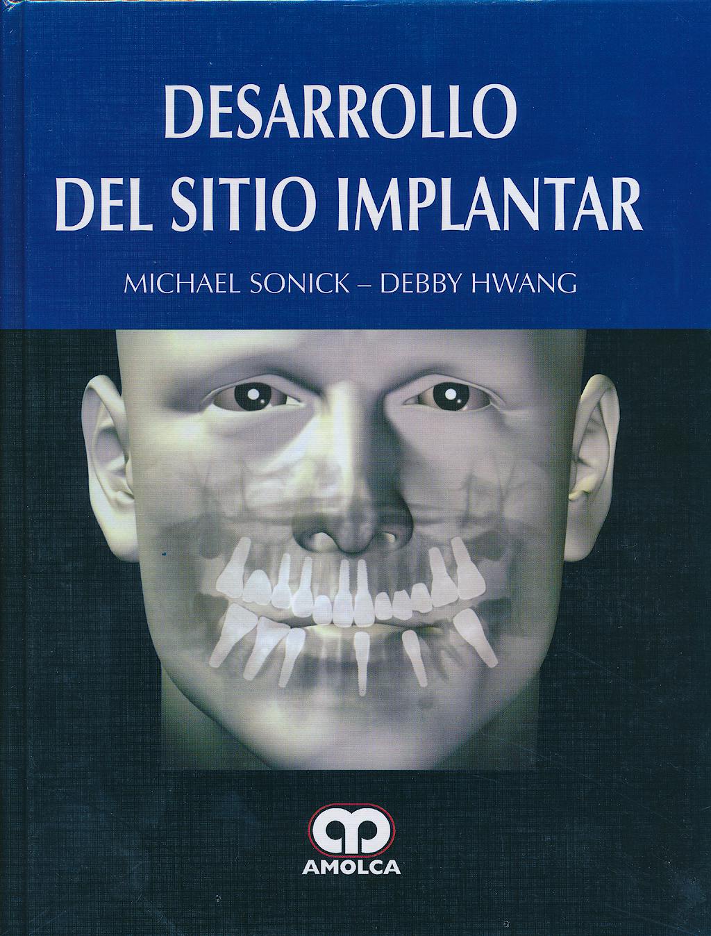 Portada del libro 9789588760636 Desarrollo del Sitio Implantar