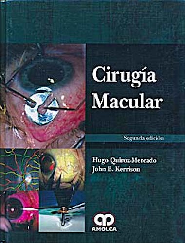 Portada del libro 9789588760643 Cirugia Macular