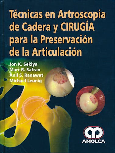 Portada del libro 9789588760698 Tecnicas en Artroscopia de Cadera y Cirugia para la Preservacion de la Articulacion