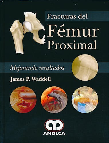 Portada del libro 9789588760773 Fracturas del Femur Proximal. Mejorando Resultados