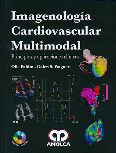 Portada del libro 9789588760797 Imagenología Cardiovascular Multimodal. Principios y Aplicaciones Clínicas