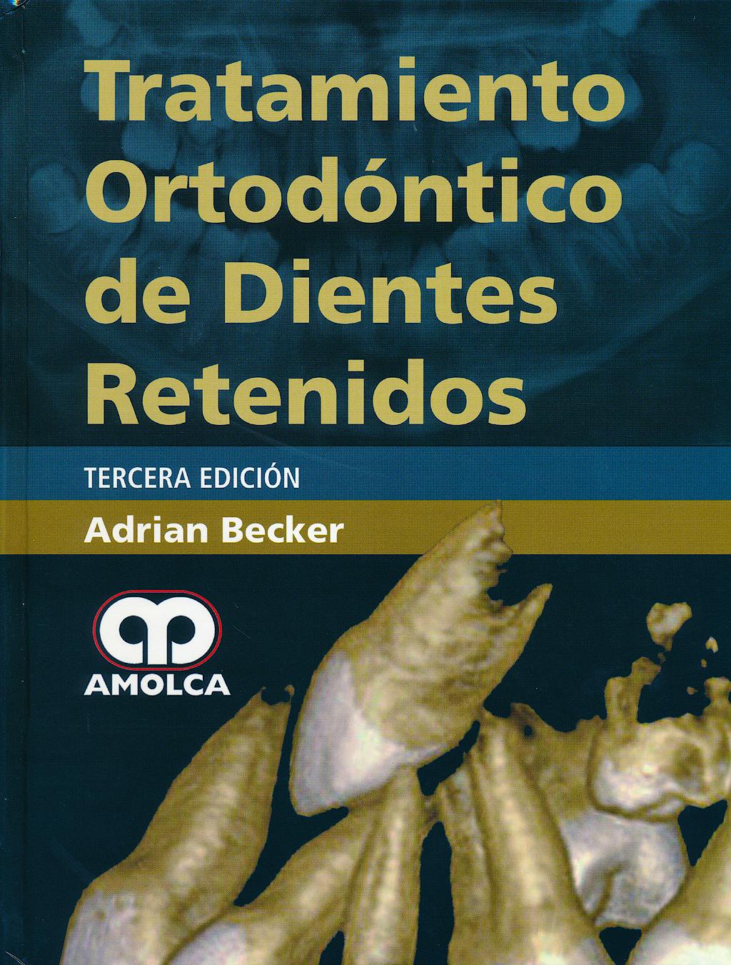 Portada del libro 9789588760803 Tratamiento Ortodóntico de Dientes Retenidos