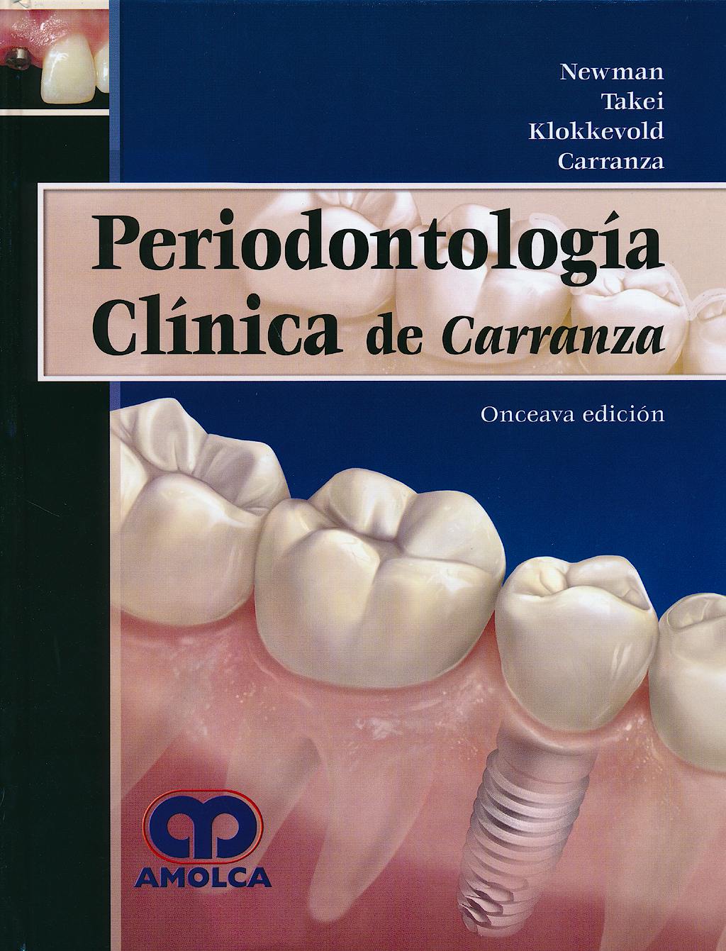 Portada del libro 9789588760841 Periodontología Clínica de Carranza