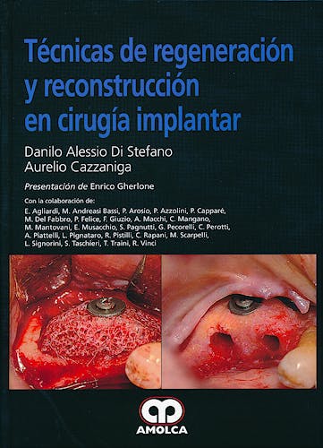 Portada del libro 9789588760872 Técnicas de Regeneración y Reconstrucción en Cirugía Implantar