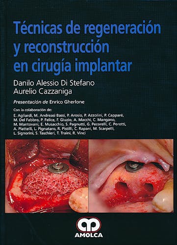 Portada del libro 9789588760872 Técnicas de Regeneración y Reconstrucción en Cirugía Implantar