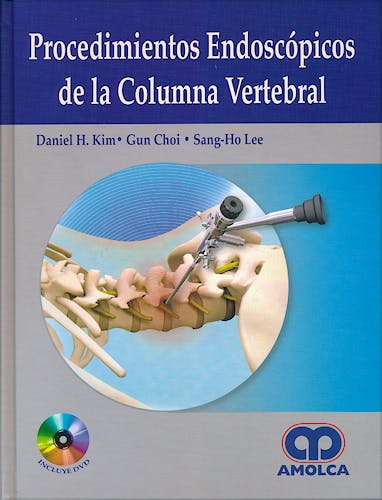 Portada del libro 9789588760995 Procedimientos Endoscópicos de la Columna Vertebral