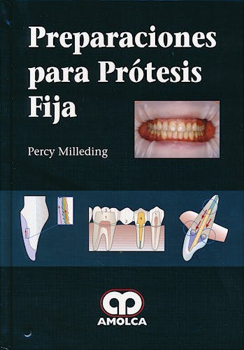 Portada del libro 9789588816036 Preparaciones para Prótesis Fija