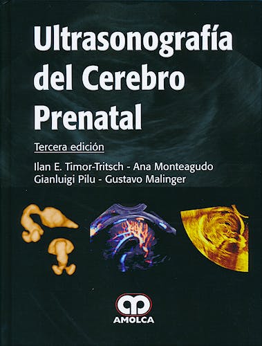 Portada del libro 9789588816081 Ultrasonografía del Cerebro Prenatal