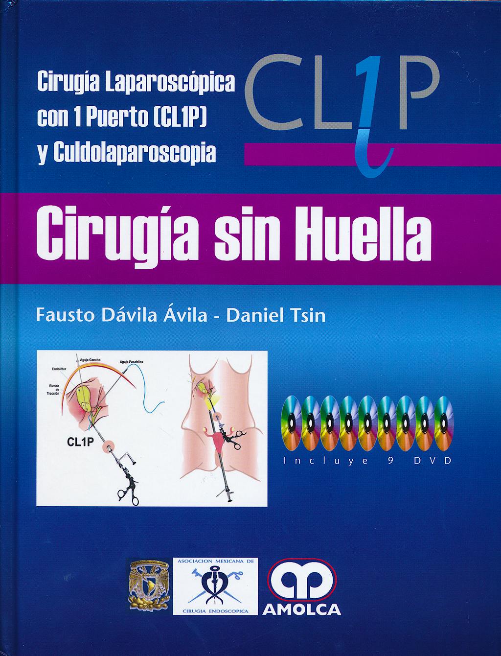 Portada del libro 9789588816159 Cirugía sin Huella. Cirugía Laparoscópica con 1 Puerto (CL1P) y Culdolaparoscopia + 9 DVD's