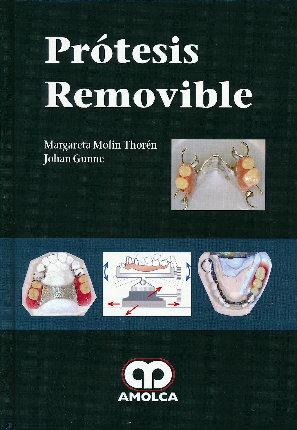 Portada del libro 9789588816227 Prótesis Removible