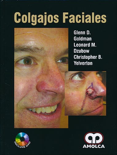 Portada del libro 9789588816326 Colgajos Faciales