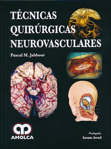 Portada del libro 9789588816371 Técnicas Quirúrgicas Neurovasculares