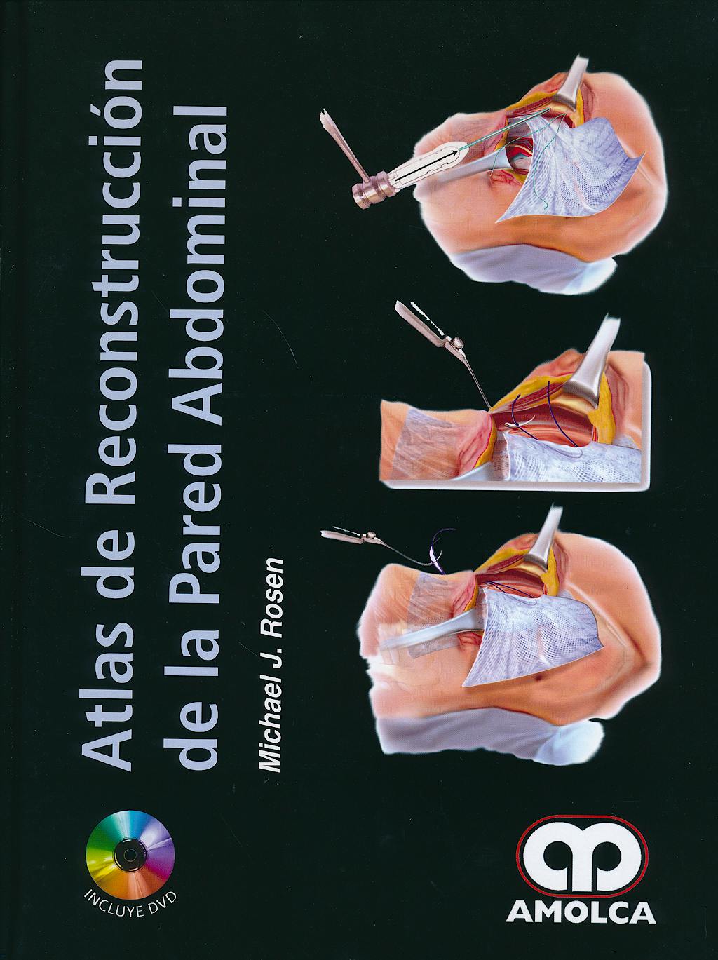 Portada del libro 9789588816401 Atlas de Reconstrucción de la Pared Abdominal + DVD