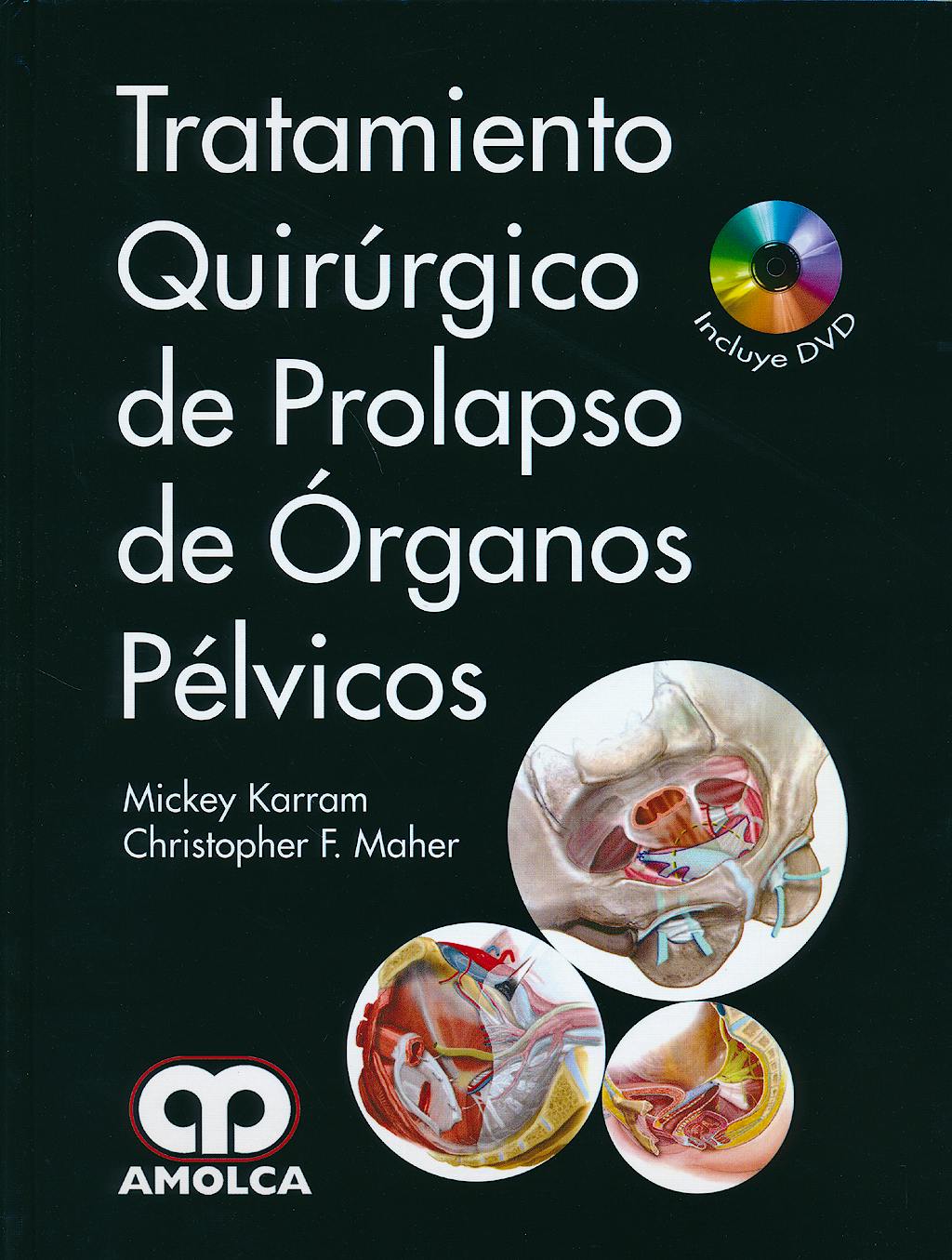 Portada del libro 9789588816531 Tratamiento Quirúrgico de Prolapso de Órganos Pélvicos + DVD