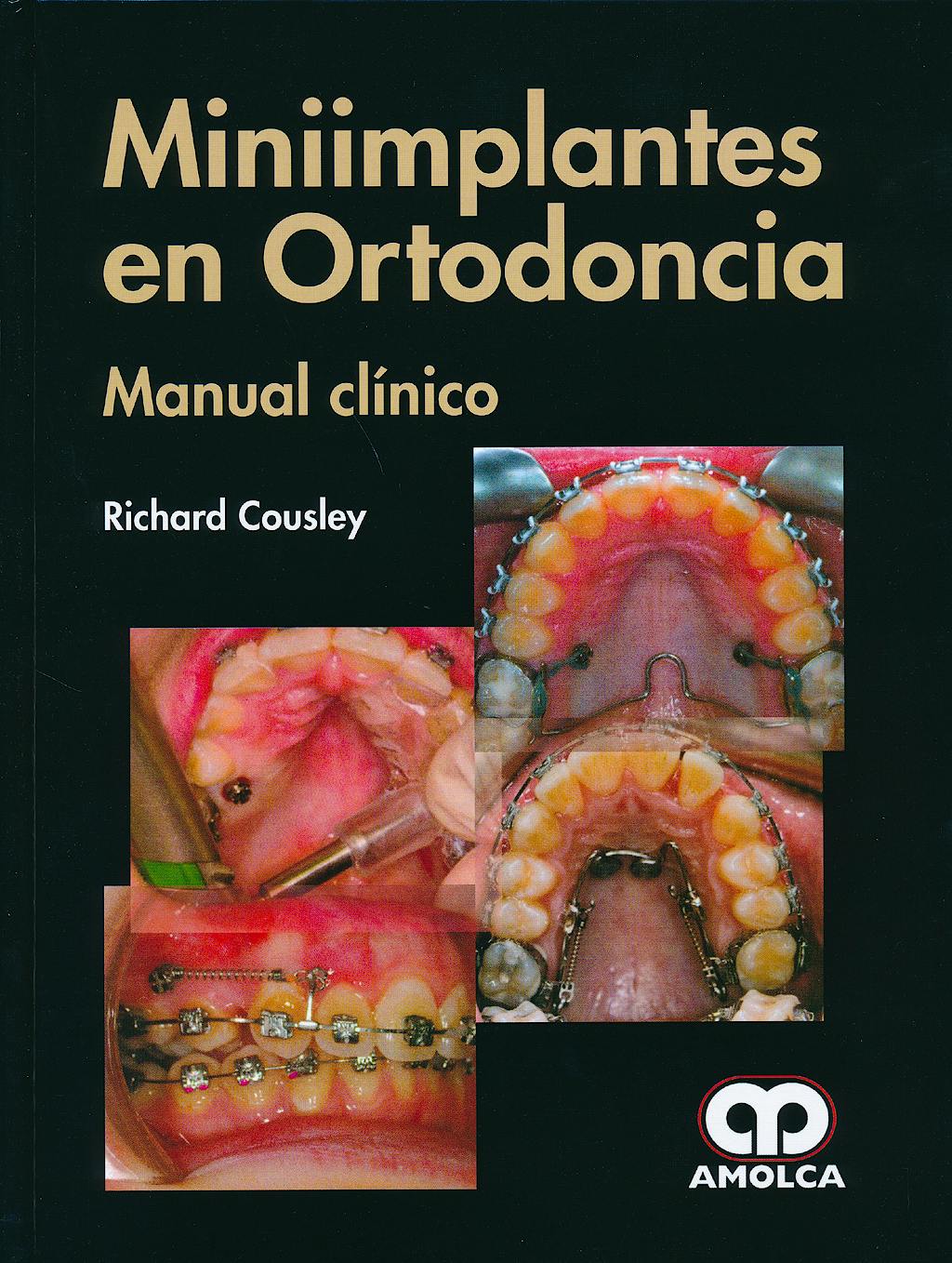 Portada del libro 9789588816593 Miniimplantes en Ortodoncia. Manual Clínico