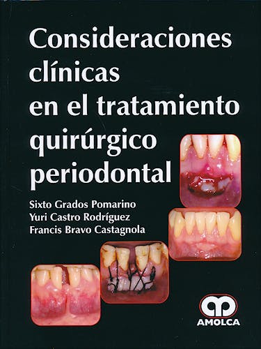 Portada del libro 9789588816692 Consideraciones Clínicas en el Tratamiento Quirúrgico Periodontal