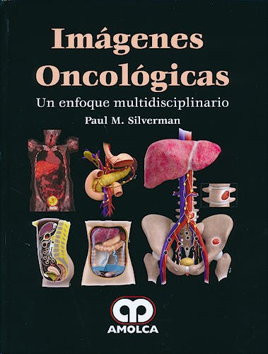 Portada del libro 9789588816739 Imágenes Oncológicas. Un Enfoque Multidisciplinario