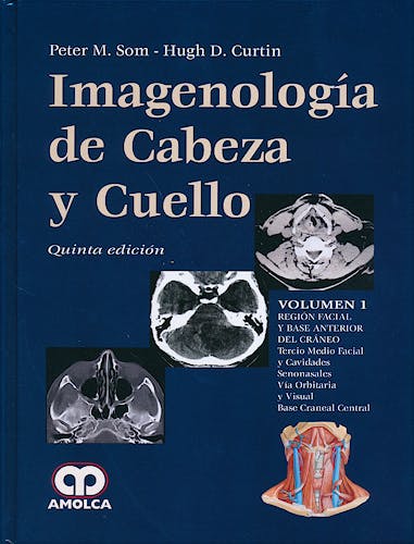 Portada del libro 9789588816951 Imagenología de Cabeza y Cuello, 3 Vols.
