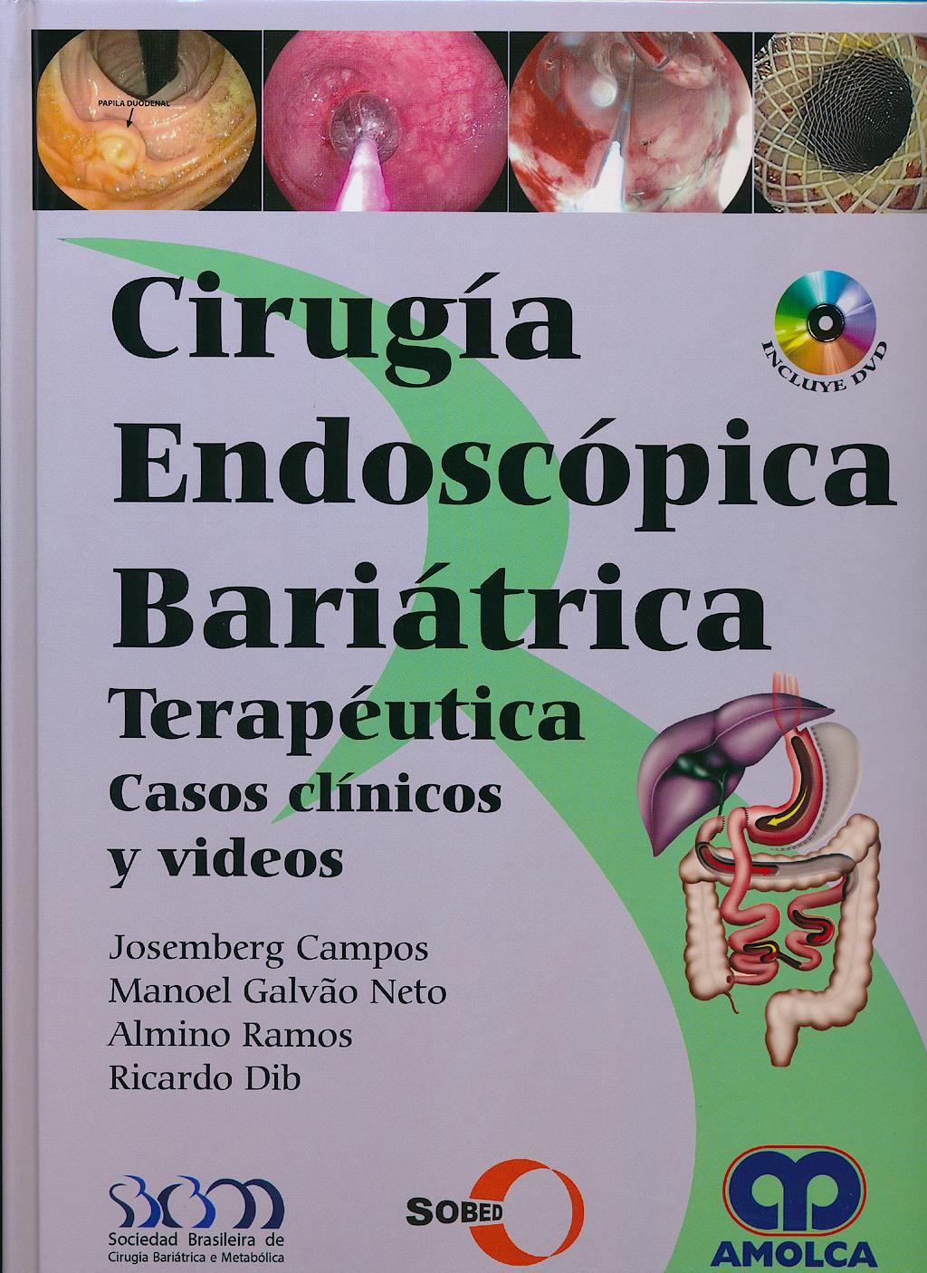 Portada del libro 9789588816982 Cirugía Endoscópica Bariátrica Terapéutica. Casos Clínicos y Videos
