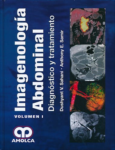 Portada del libro 9789588816999 Imagenología Abdominal. Diagnóstico y Tratamiento, 2 Vols.