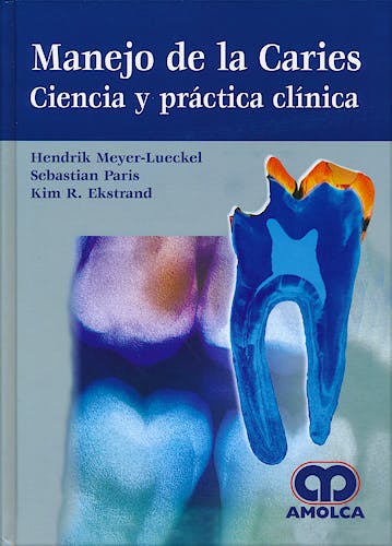 Portada del libro 9789588871196 Manejo de la Caries. Ciencia y Práctica Clínica