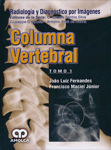 Portada del libro 9789588871431 Columna Vertebral, 2 Vols. (Radiologia y Diagnostico por Imagenes)