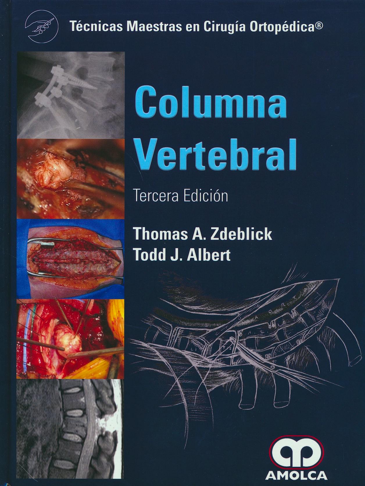 Portada del libro 9789588871448 Columna Vertebral (Técnicas Maestras en Cirugía Ortopédica)