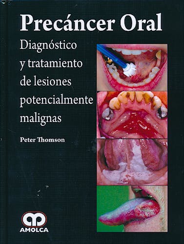 Portada del libro 9789588871585 Precáncer Oral. Diagnóstico y Tratamiento de Lesiones Potencialmente Malignas