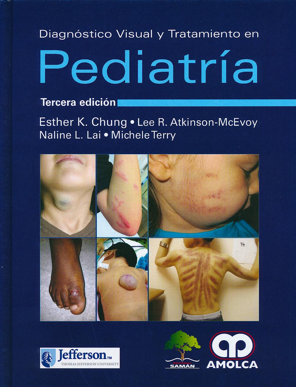 Portada del libro 9789588871714 Diagnóstico Visual y Tratamiento en Pediatría
