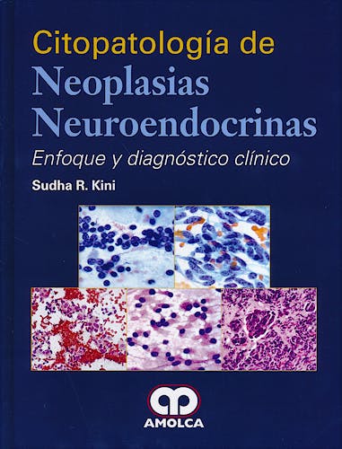 Portada del libro 9789588871738 Citopatología de Neoplasias Neuroendocrinas. Enfoque y Diagnóstico Clínico